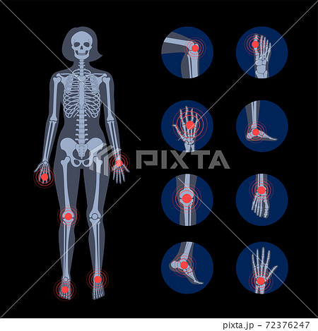 Human bones concept 72376247