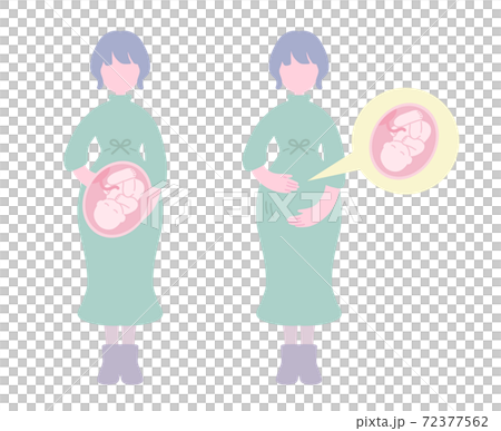 妊娠中の女性 72377562