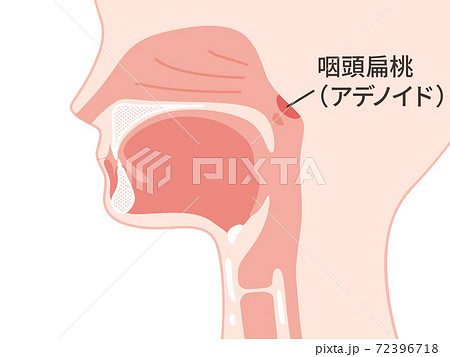 頭部_矢状断_アデノイド_咽頭扁桃のイラスト 頭部_矢状断_アデノイド_咽頭扁桃のイラスト 72396718