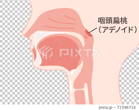 頭部_矢状断_アデノイド_咽頭扁桃のイラスト 頭部_矢状断_アデノイド_咽頭扁桃のイラスト 72396718