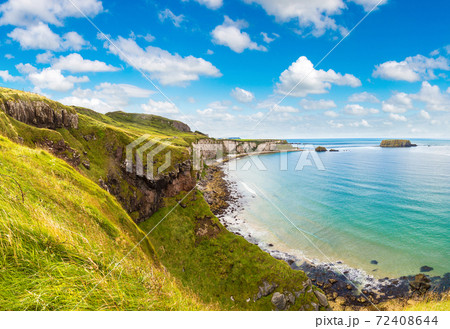 Carrick-a-Rede, Causeway Coast 72408644
