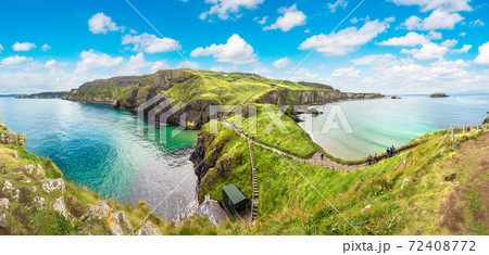 Carrick-a-Rede, Causeway Coast 72408772