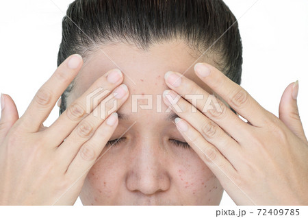 laser treatment 72409785