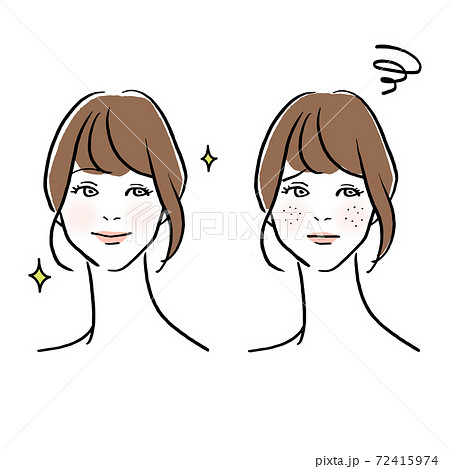 肌トラブルに悩む女性のイラストのイラスト素材