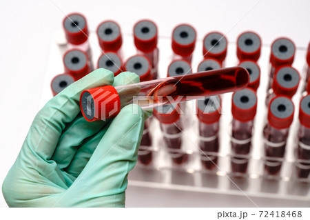 hands of a lab technician with a test tube of blood sample and a rack with other samples over light grey background 72418468
