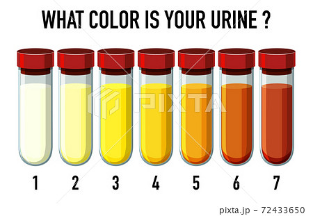 Illustration of urine color chart Illustration of urine color chart 72433650