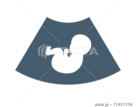 The Baby silhouette in ultrasound scan. Isolated Vector Illustration The Baby silhouette in ultrasound scan. Isolated Vector Illustration 72457256