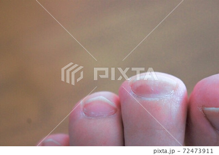 足の爪 足の爪 72473911