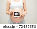 Pregnant girl shows an ultrasound photo of her undorn baby. Portrait of a child on an ultrasound photo 72482658