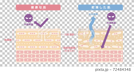 健康な肌と乾燥肌を比較した肌の断面図、イラスト 72484348