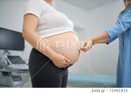 Doctor using measuring tape while examining woman's belly 72491833
