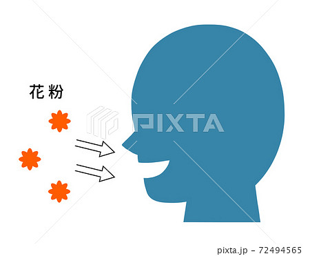 花粉症・アレルギーのメカニズム　発症 72494565