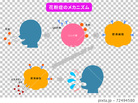 授粉和過敏機制概述：擠壓，鼻涕，眼睛發癢 72494580