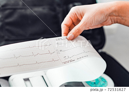Examination of the patient's cardiac diagnosis, cardiogram, examination of human cardiovascular diseases, cardiograph and laboratory assistant. 72531627