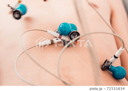 The nurse prepares the patient for the cardiogram, the cardiograph and the patient, the medical device for measuring the cardiogram. The nurse prepares the patient for the cardiogram, the cardiograph and the patient, the medical device for measuring the cardiogram. 72531634