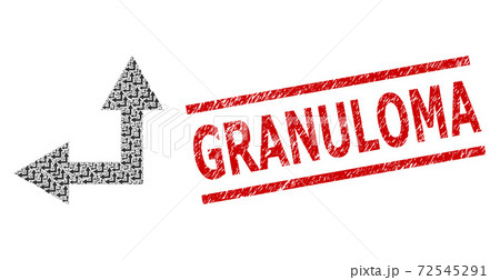 Bifurcation Arrow Left Up Fractal Composition of Bifurcation Arrow Left Up Icons and Grunge Granuloma Seal Bifurcation Arrow Left Up Fractal Composition of Bifurcation Arrow Left Up Icons and Grunge Granuloma Seal 72545291