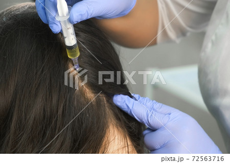 Doctor trichologist makes injections in woman's skin on head for hair growth. Doctor trichologist makes injections in woman's skin on head for hair growth. 72563716