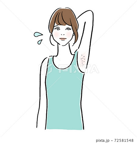 脱毛、ワキをきにする女性のイラスト 72581548
