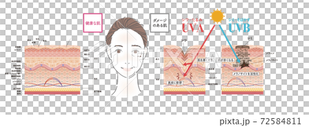 皮膚 斑 老化斑 72584811