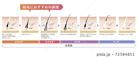 Cross section of the skin 17 front 72584851