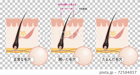 Cross section of the skin 13 front 72584857