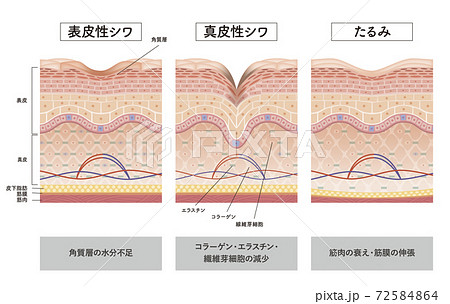 Cross section of the skin 10 front 72584864