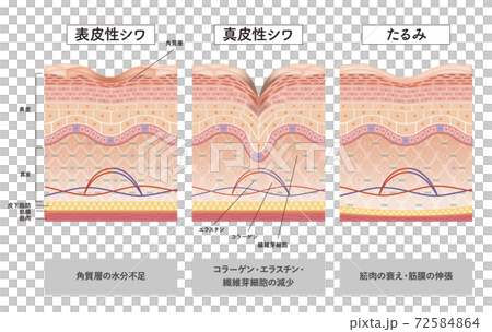 Cross section of the skin 10 front 72584864