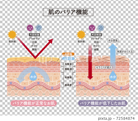 skin, skinned, cross-section diagram 72584874