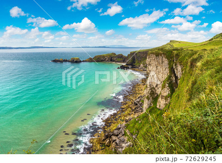 Carrick-a-Rede, Causeway Coast 72629245