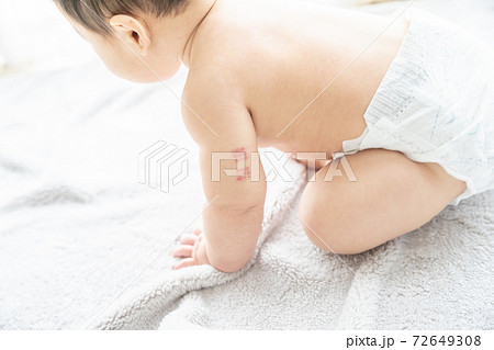 窓辺でお座りをする腕にBCGの痕がある赤ちゃん 窓辺でお座りをする腕にBCGの痕がある赤ちゃん 72649308
