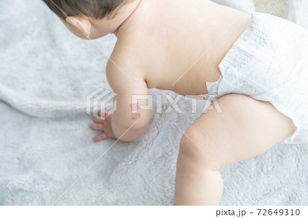 窓辺でお座りをする腕にBCGの痕がある赤ちゃん 72649310