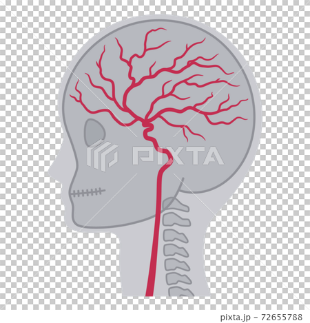 脳血管造影のイラスト 72655788