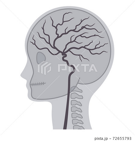 脳血管造影のイラストのイラスト素材