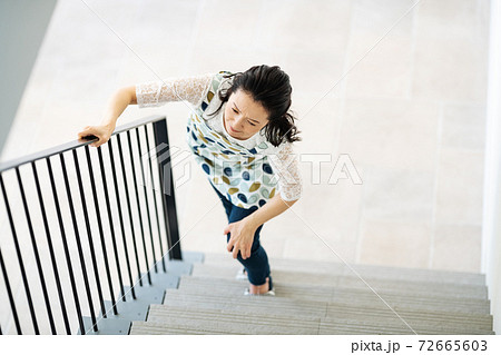 膝が痛くて階段を登ることが辛い女性 72665603