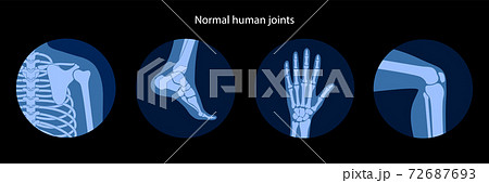 Human bones concept 72687693