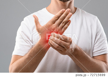Unrecognizable man scratching itch on his hand Unrecognizable man scratching itch on his hand 72715699