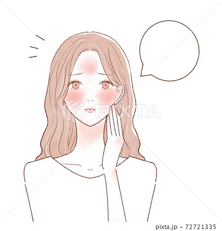 スキンケア　女性　ヒリヒリ　吹き出し 72721335