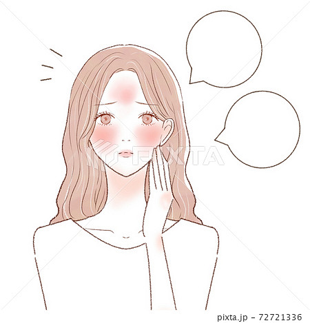 スキンケア　女性　ヒリヒリ　吹き出し2 72721336