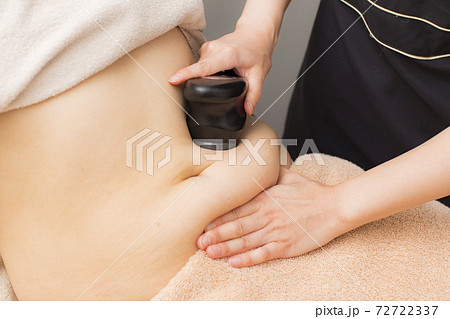 お腹の脂肪吸引 お腹の脂肪吸引 72722337