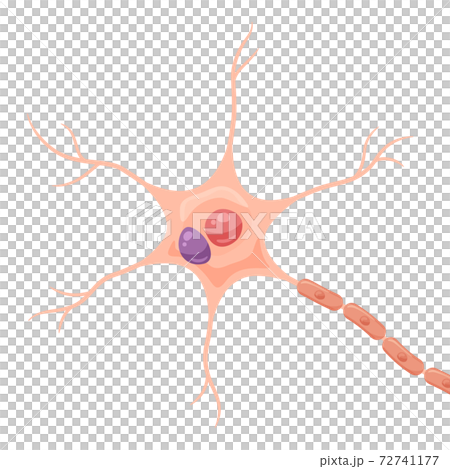 レビー小体の出来たニューロンのイラスト 72741177