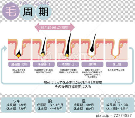 脱毛における毛周期のわかりやすいイラスト 72774887