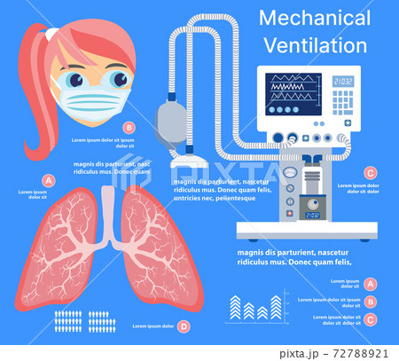 Virus lung infection medicine medical disease infection 72788921