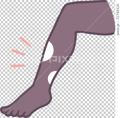 Illustration material of torn tights 72789320