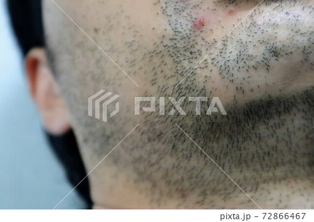 毛深い髭の男性のクローズアップ 72866467