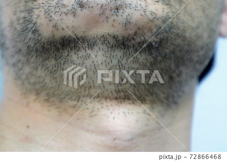 男性の毛深い髭のクローズアップ 72866468