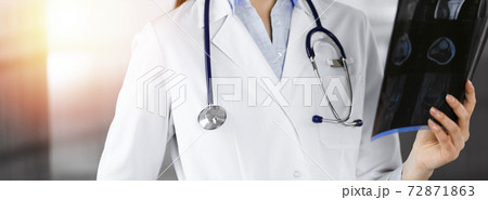 Professional young woman doctor is looking at her patient's roentgenogram in sunny clinic. Medicine concept during Coronavirus pandemic. Covid-2019 72871863