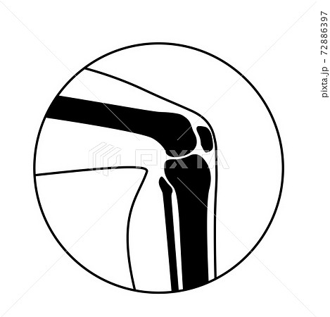 Human Normal Bones Human Normal Bones 72886397