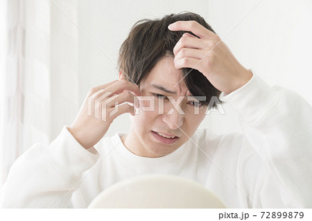 生え際を気にする男性 生え際を気にする男性 72899879