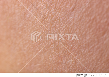 human skin texture 72905307
