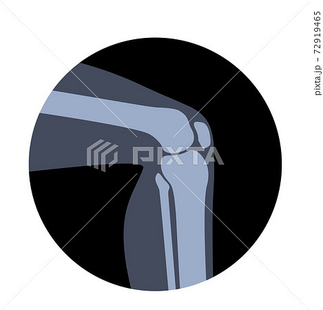 Human Normal Bones 72919465